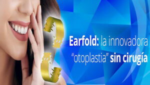 Otoplastia-Sin-Cirugía-Ear-Fold-