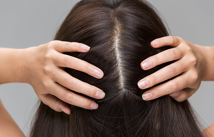 Factores que afectan al cabello y al cuero cabelludo